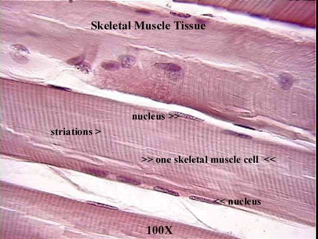 Skeletal muscle longitudinal 400x